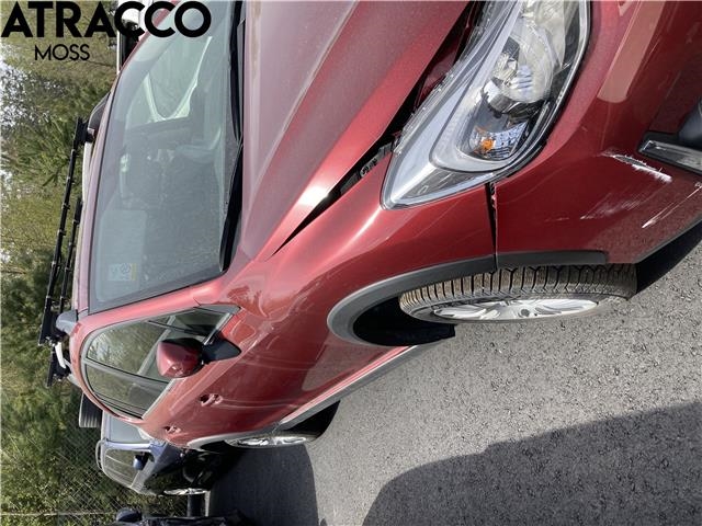 Subaru XV 2012-2017 (Type I) , Motorkode: FB20, Girkassekode: Automat